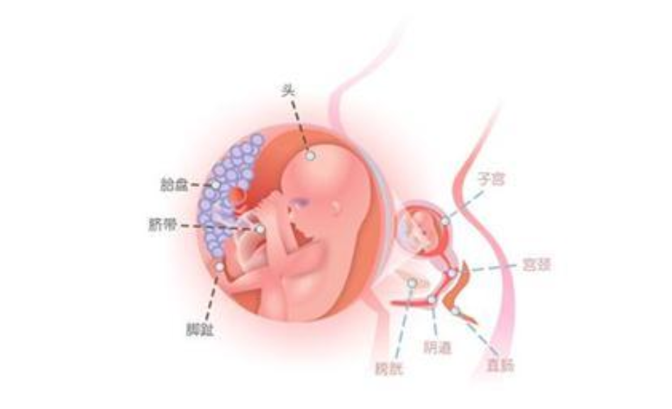 孕37周，发现血压升高1+月，头痛1周，恶心、呕吐1天