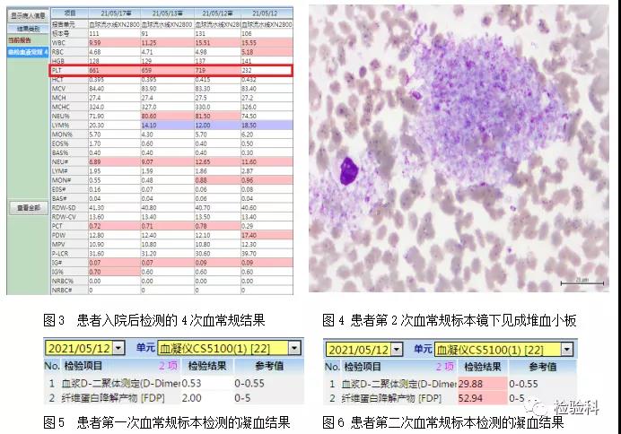 短短6小时，两次血小板计数结果竟相差3倍多