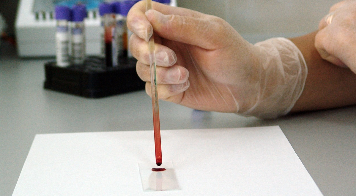国家卫健委修订血栓与止血检验常用项目的标本采集与处理标准